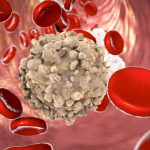 Il tumore al sangue: conosciamolo meglio