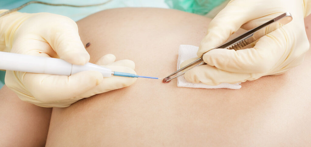 https://www.dermatologiamilano.it/