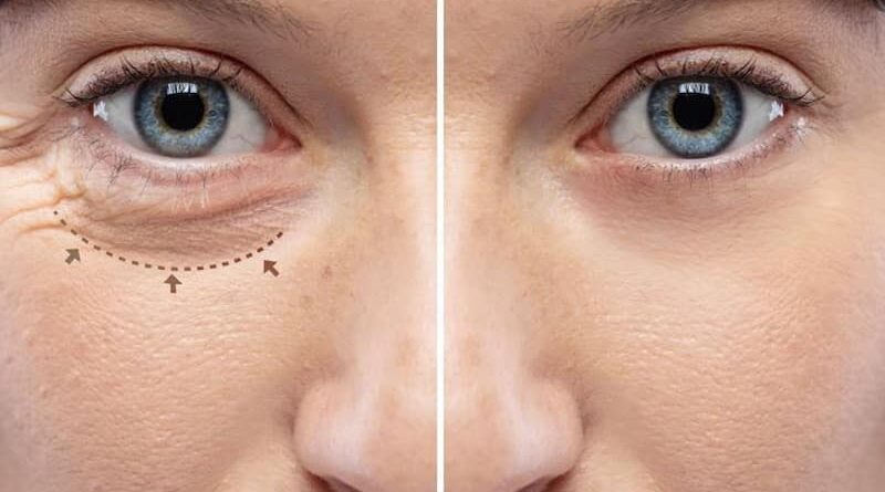 https://www.blefaroplasticamilano.eu/